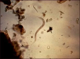 larva de anquilostoma