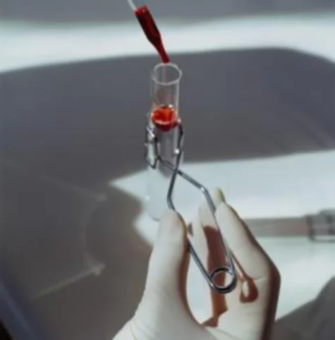 Prepación de anticoagulantes